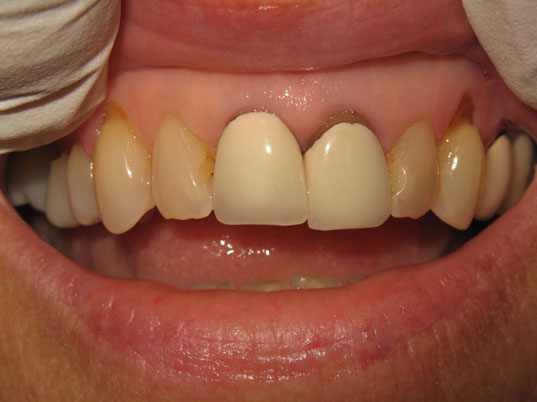 Restorative Dentistry Before